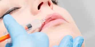 close-up image of a woman receiving dermal fillers to her lips