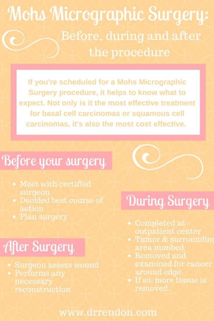 What to Know Before Mohs Surgery Rendon Center for Dermatology