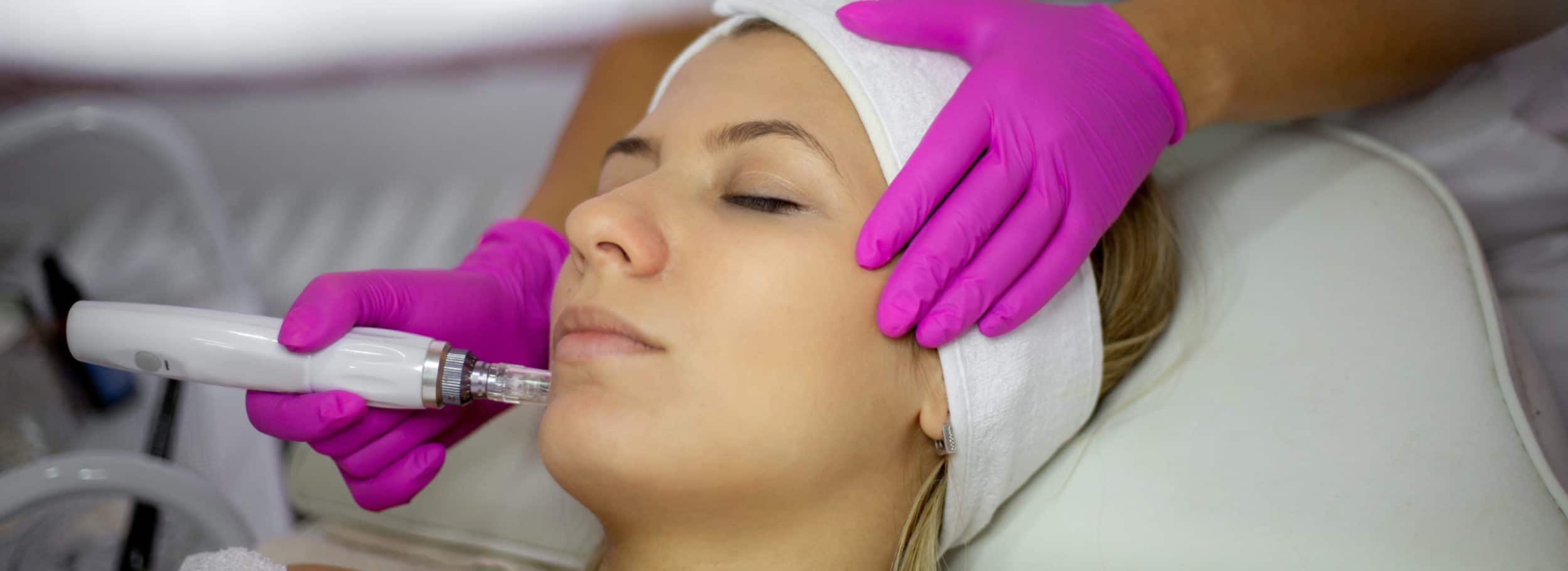 Close up image of a woman getting a microneedling treatment in Boca Raton, FL