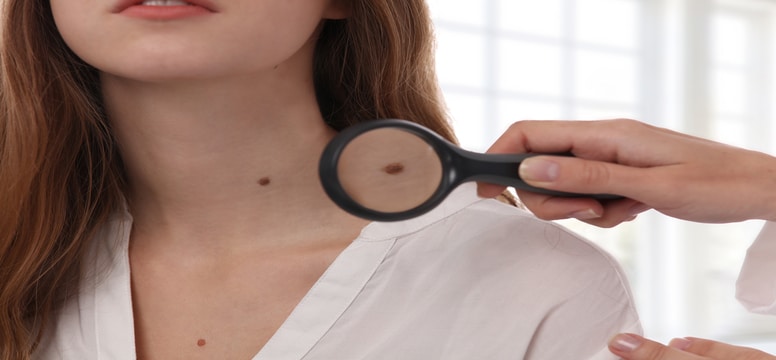 dermatologist examining a mole on a women's neck - mole removal boca raton