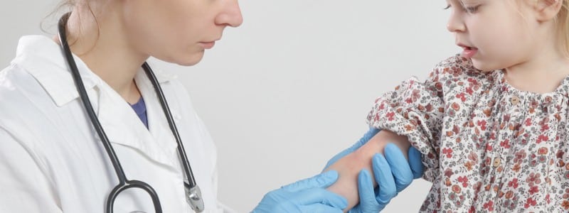 Doctor looking at red and itchy eczema on little girl's arm