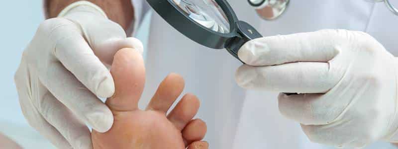 Doctor dermatologist examines the foot on the presence of athlete's foot
