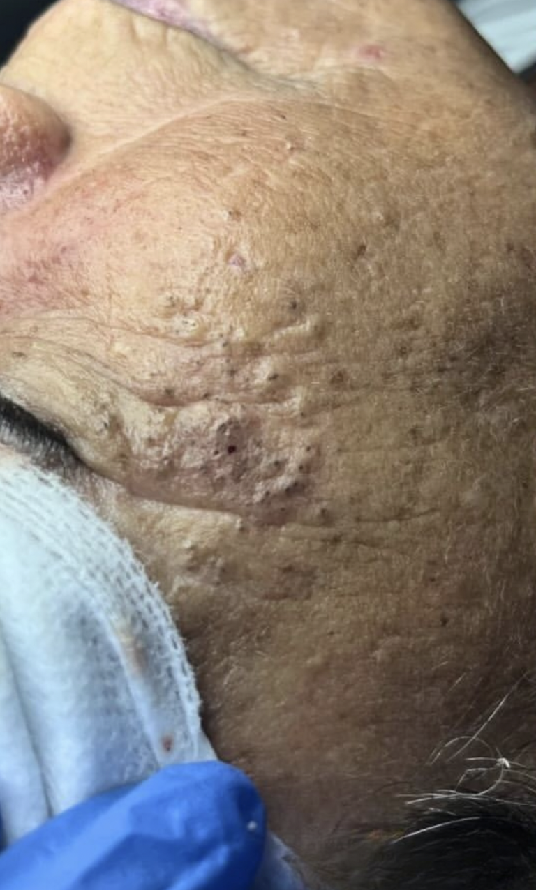 Before Image: Extractions - right-side